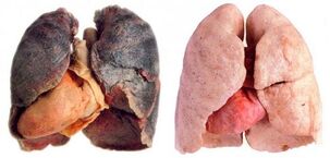 rūkaliaus plaučiai ir sveiki